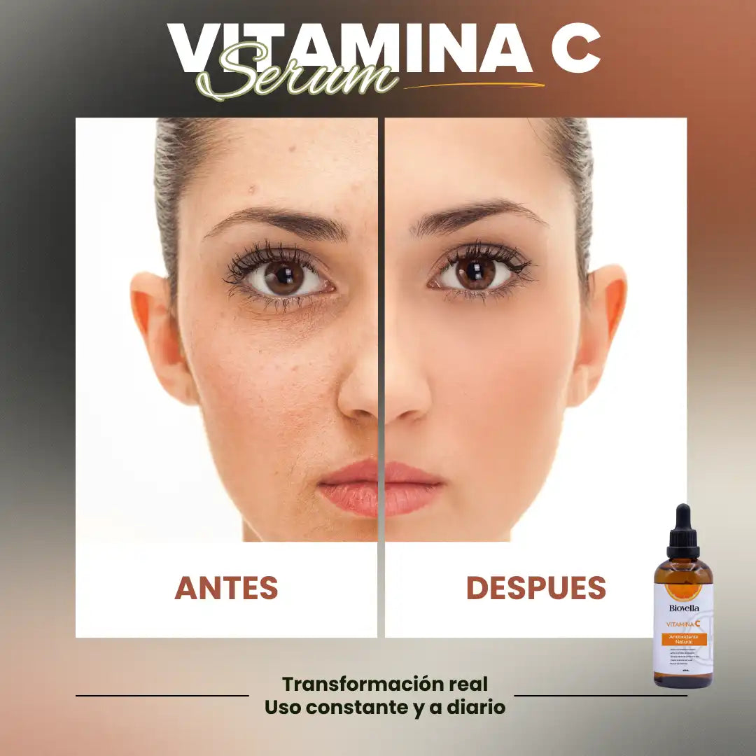 Radiance+™ Biovella | Serum Vitamina C | Activa el brillo natural de tu piel | Reduce manchas