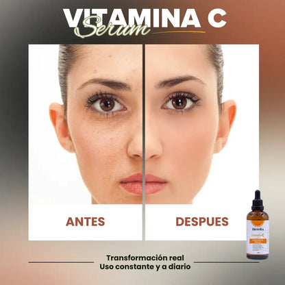 Radiance+™ Biovella | Serum Vitamina C | Activa el brillo natural de tu piel | Reduce manchas
